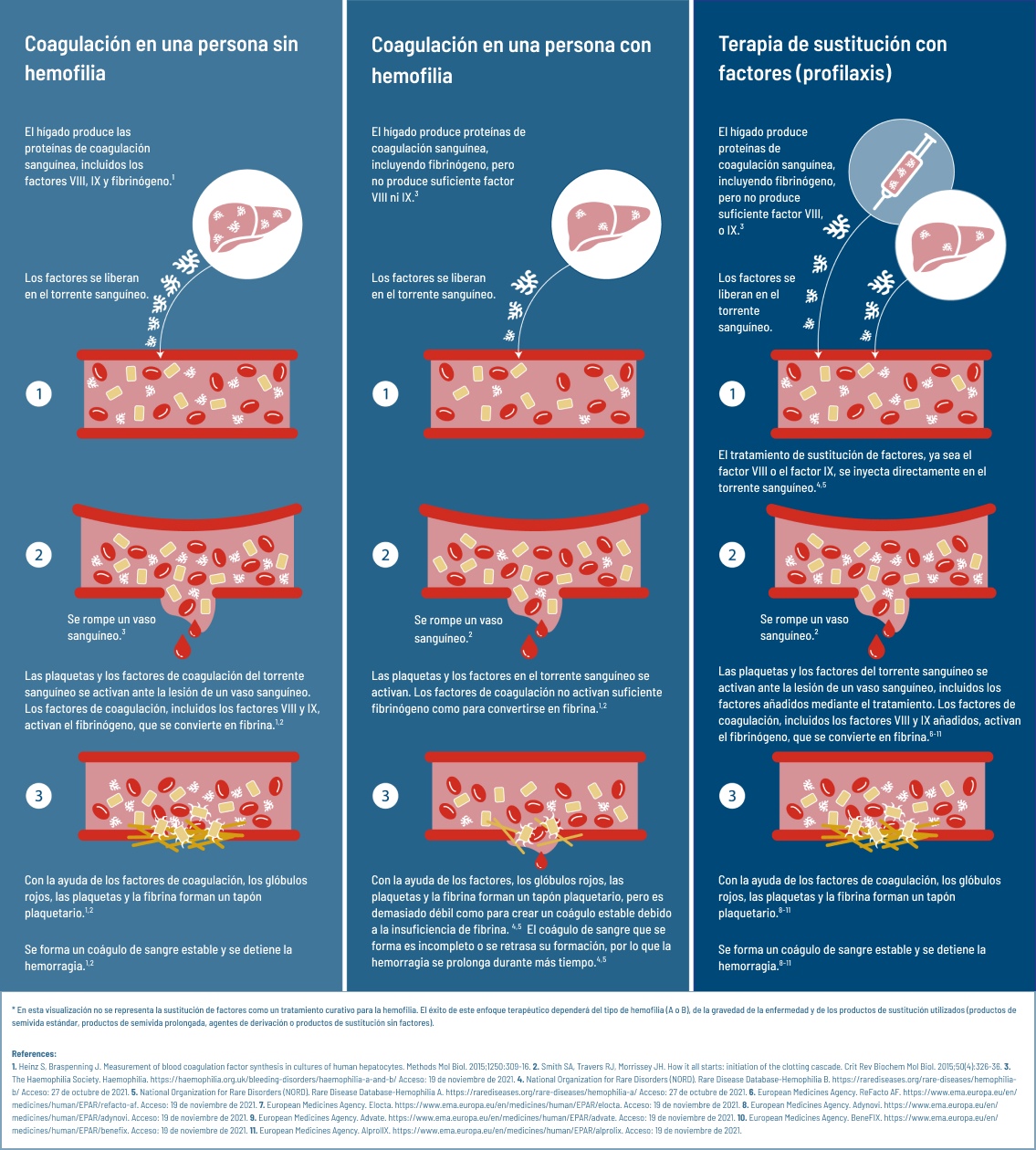 Diferencia entre la coagulación normal en una persona sin hemofilia, coagulación en hemofilia y terapia de reemplazo con factor (profilaxis)